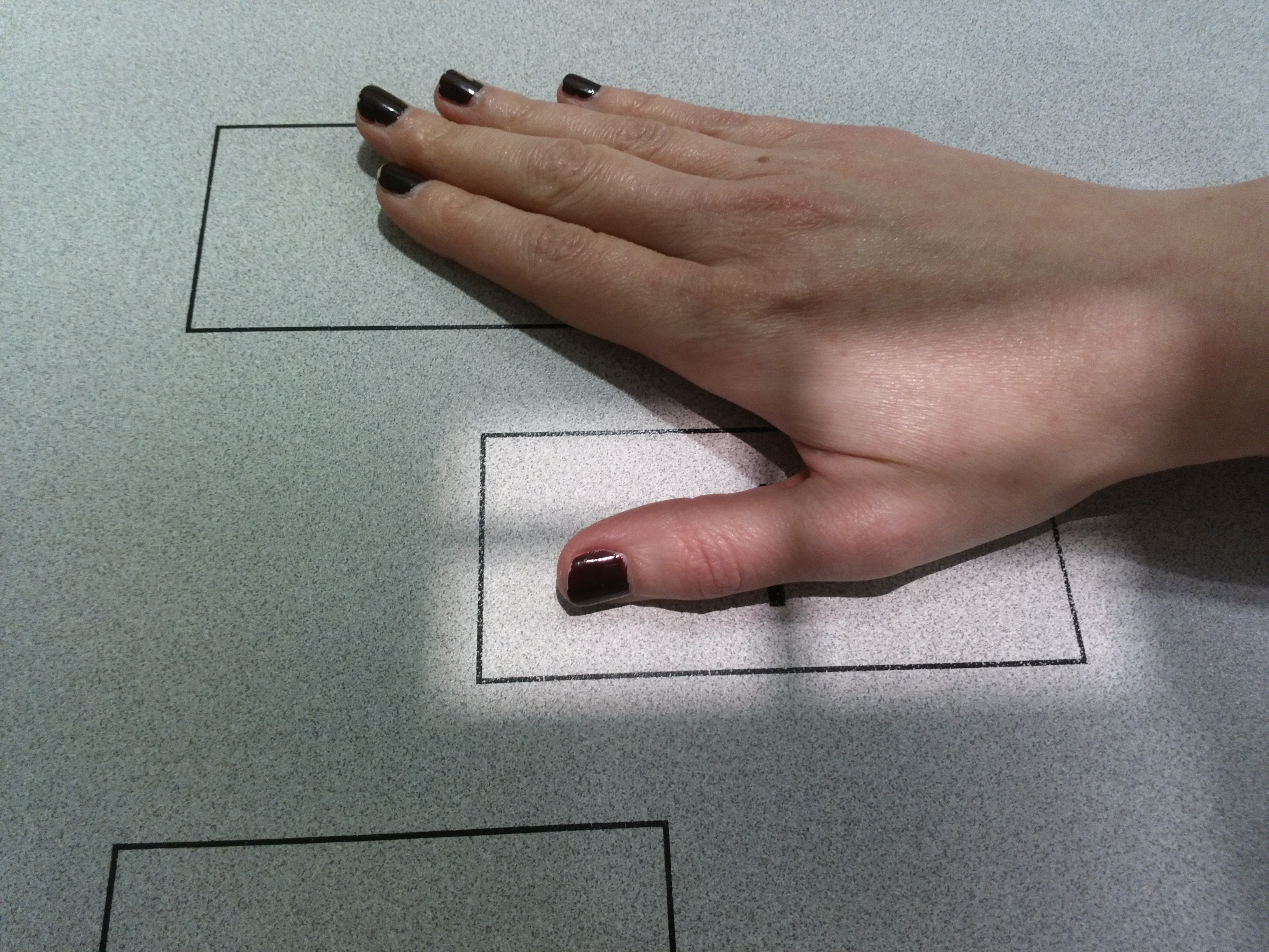 Proyección oblicua pulgar